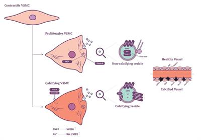 Initiation and Propagation of Vascular Calcification Is Regulated by a Concert of Platelet- and Smooth Muscle Cell-Derived Extracellular Vesicles